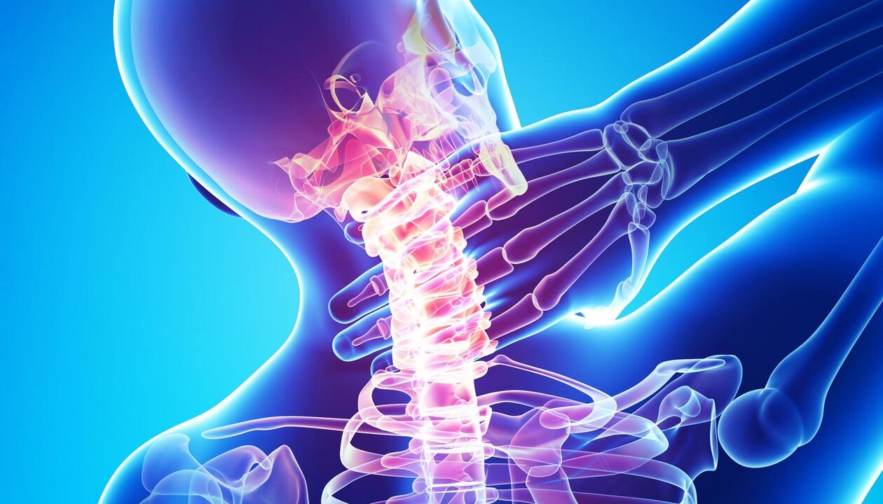 bolesť krku v dôsledku osteochondrózy