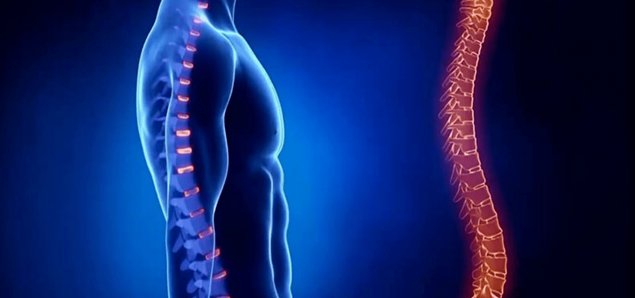 lézie chrbtice v dôsledku osteochondrózy